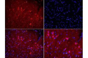 Immunofluorescence (Paraffin-embedded Sections) (IF (p)) image for anti-Cytochrome B-245, beta Polypeptide (CYBB) (AA 501-570) antibody (ABIN750688)