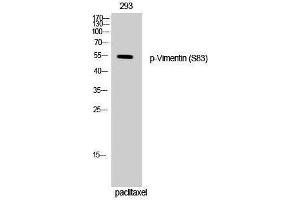 Western Blotting (WB) image for anti-Vimentin (VIM) (pSer83) antibody (ABIN3179696) (Vimentin 抗体  (pSer83))
