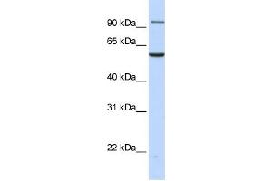 WB Suggested Anti-TNPO2 Antibody Titration: 0. (TNPO2 抗体  (N-Term))