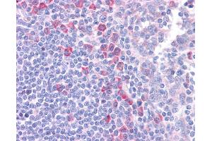 DLL1 antibody was used for immunohistochemistry at a concentration of 4-8 ug/ml. (DLL1 抗体)
