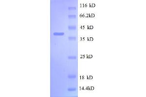 SDS-PAGE (SDS) image for Ribosomal Protein S13 (RPS13) (AA 2-118) protein (GST tag) (ABIN5712606)