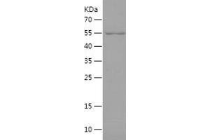 Western Blotting (WB) image for MORC Family CW-Type Zinc Finger 3 (MORC3) (AA 1-290) protein (His-IF2DI Tag) (ABIN7124019) (MORC3 Protein (AA 1-290) (His-IF2DI Tag))