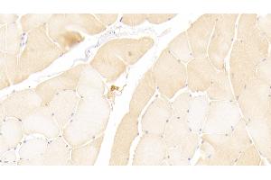 Detection of MMP1 in Human Skeletal muscle Tissue using Polyclonal Antibody to Matrix Metalloproteinase 1 (MMP1) (MMP1 抗体  (AA 98-275))