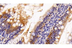 Immunohistochemistry (IHC) image for anti-Galectin 4 (LGALS4) (AA 1-323) antibody (ABIN7431569)