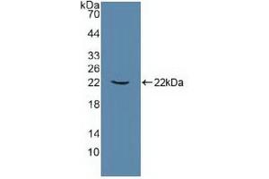 Figure. (ATP1A1 抗体  (AA 493-660))