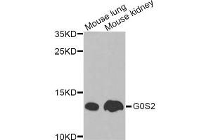 Western blot analysis of extracts of various cell lines, using G0S2 Antibody. (G0S2 抗体)