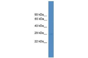 WB Suggested Anti-UBTD1 Antibody Titration: 0. (UBTD1 抗体  (Middle Region))