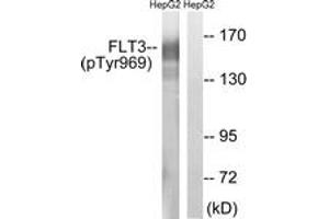 Western blot analysis of extracts from HepG2 cells treated with Na3VO4 0. (FLT3 抗体  (pTyr969))