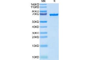 SDS-PAGE (SDS) image for alpha-Fetoprotein (AFP) (AA 19-609) protein (His tag) (ABIN7273808)