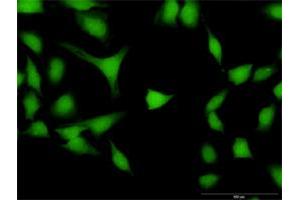 Immunofluorescence of purified MaxPab antibody to DPF2 on HeLa cell. (DPF2 抗体  (AA 1-391))