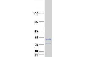 Validation with Western Blot (KCNE1-Like Protein (KCNE1L) (Myc-DYKDDDDK Tag))