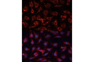 Immunofluorescence analysis of C6 cells using PDH Polyclonal Antibody (ABIN6132882, ABIN6145379, ABIN6145381 and ABIN6225274) at dilution of 1:100 (40x lens). (PDHA2 抗体  (AA 119-388))