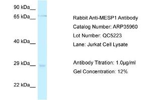 WB Suggested Anti-MESP1 Antibody   Titration: 1. (MESP1 抗体  (C-Term))