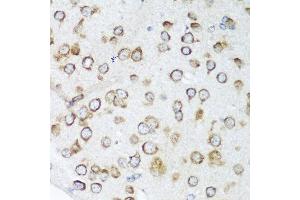Immunohistochemistry of paraffin-embedded mouse brain using NOTCH2 antibody at dilution of 1:100 (40x lens). (NOTCH2 抗体)