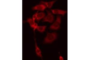 ABIN6278591 staining Hela by IF/ICC. (C18orf8 抗体  (C-Term))