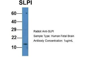 Host: Rabbit  Target Name: SLPI  Sample Tissue: Human Fetal Brain  Antibody Dilution: 1. (SLPI 抗体  (N-Term))