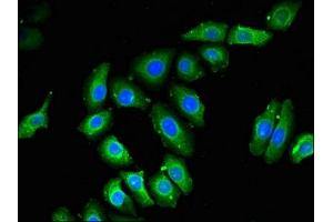 Immunofluorescent analysis of A549 cells using ABIN7168384 at dilution of 1:100 and Alexa Fluor 488-congugated AffiniPure Goat Anti-Rabbit IgG(H+L) (NOB1 抗体  (AA 103-229))