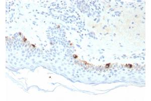Formalin-fixed, paraffin-embedded human Skin stained with TYRP1-Monospecific Mouse Monoclonal Antibody (TYRP1/3281). (Tyrosinase-Related Protein 1 抗体  (AA 257-377))