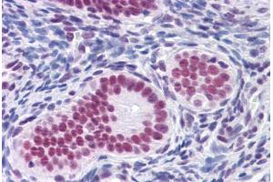 Human Uterus: Formalin-Fixed, Paraffin-Embedded (FFPE) (RUNX2 抗体  (AA 251-351))