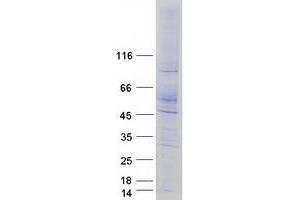 Western Blotting (WB) image for Solute Carrier Family 18 (Vesicular Monoamine Transporter), Member 2 (SLC18A2) protein (Myc-DYKDDDDK Tag) (ABIN2732151)
