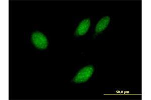Immunofluorescence of purified MaxPab antibody to TXNL4B on HeLa cell. (TXNL4B 抗体  (AA 1-149))