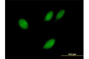 Immunofluorescence of purified MaxPab antibody to TXNL4B on HeLa cell.