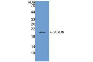 Western blot analysis of recombinant Human ADM. (Adrenomedullin 抗体  (AA 22-147))