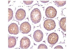 IHC analysis of WWOX using anti-WWOX antibody (ABIN6719627). (WWOX 抗体  (AA 1-245))