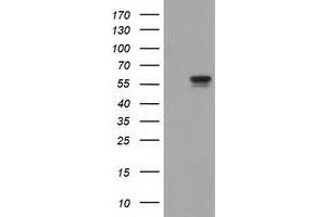 HEK293T cells were transfected with the pCMV6-ENTRY control (Left lane) or pCMV6-ENTRY DYNC1LI1 (Right lane) cDNA for 48 hrs and lysed. (DYNC1LI1 抗体)