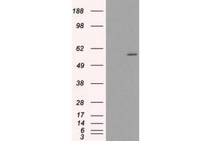 HEK293T cells were transfected with the pCMV6-ENTRY control (Left lane) or pCMV6-ENTRY CYP2E1 (Right lane) cDNA for 48 hrs and lysed. (CYP2E1 抗体)