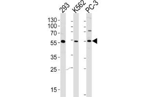 Western Blotting (WB) image for anti-Phosphatidylinositol-4-Phosphate 5-Kinase-Like 1 (PIP5KL1) antibody (ABIN2996126) (PIP5KL1 抗体)