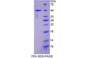 SDS-PAGE analysis of Human Keratin 7 Protein. (Cytokeratin 7 蛋白)