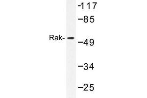 Image no. 1 for anti-Fyn-Related Kinase (FRK) antibody (ABIN272190) (FRK 抗体)