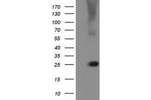 Western Blotting (WB) image for anti-RAB, Member of RAS Oncogene Family-Like 2A (RABL2A) antibody (ABIN1500577) (RABL2A 抗体)