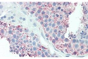 Detection of UCN2 in Human Testis Tissue using Polyclonal Antibody to Urocortin 2 (UCN2) (Urocortin 2 抗体  (AA 23-107))