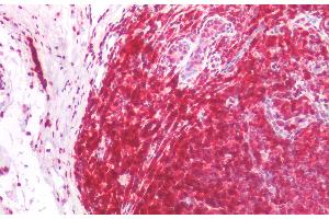 Immunohistochemistry staining of human tonsil (paraffin-embedded sections) with anti-CD45RA (MEM-56), 5 μg/mL. (CD45RA 抗体)
