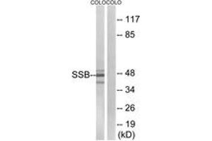 Western blot analysis of extracts from COLO cells, using SSB (Ab-366) Antibody. (SSB 抗体  (AA 341-390))