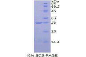 SDS-PAGE analysis of Human COMT Protein. (COMT 蛋白)
