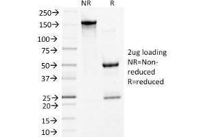 SDS-PAGE Analysis Purified Desmoglein-3 Monoclonal Antibody (5G11). (Desmoglein 3 抗体)