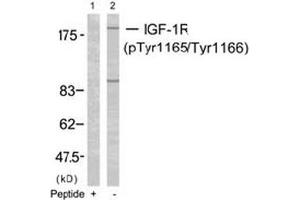 Image no. 2 for anti-Insulin-Like Growth Factor 1 Receptor (IGF1R) (pTyr1165), (pTyr1166) antibody (ABIN196774) (IGF1R 抗体  (pTyr1165, pTyr1166))