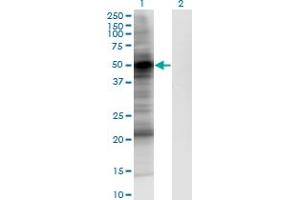 Western Blot analysis of PDPK1 expression in transfected 293T cell line by PDPK1 monoclonal antibody (M05), clone 2E2. (PDPK1 抗体  (AA 457-556))