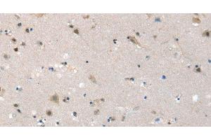 Immunohistochemistry of paraffin-embedded Human brain tissue using SLC6A7 Polyclonal Antibody at dilution 1:30 (SLC6A7 抗体)