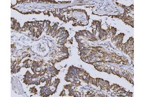 IHC analysis of Heme oxygenase 2/HMOX2 using anti-Heme oxygenase 2/HMOX2 antibody (ABIN7601766).