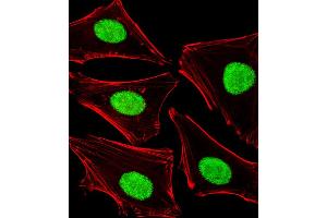 Fluorescent image of Hela cells stained with POLDIP3 Antibody (N-term). (POLDIP3 抗体  (N-Term))