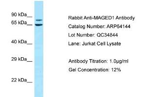 Western Blotting (WB) image for anti-Melanoma Antigen Family D, 1 (MAGED1) (C-Term) antibody (ABIN2789745) (MAGED1 抗体  (C-Term))