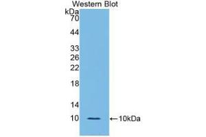 Western blot analysis of the recombinant protein. (IL-6 Receptor 抗体  (AA 385-462))