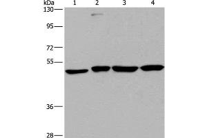 Western Blot analysis of A431, HepG2, Raji and K562 cell using CCR6 Polyclonal Antibody at dilution of 1:966 (CCR6 抗体)