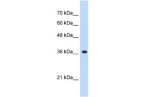 Western Blotting (WB) image for anti-alpha-1,4-N-Acetylglucosaminyltransferase (A4GNT) antibody (ABIN2463051) (A4GNT 抗体)