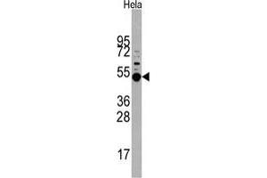 Western blot analysis of MAPKAPK5 Antibody in Hela cell line lysates (35 µg/lane). (MAPKAP Kinase 5 抗体  (Thr182))