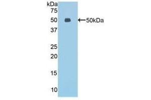 Detection of Recombinant ESM1, Mouse using Polyclonal Antibody to Endothelial Cell Specific Molecule 1 (ESM1)